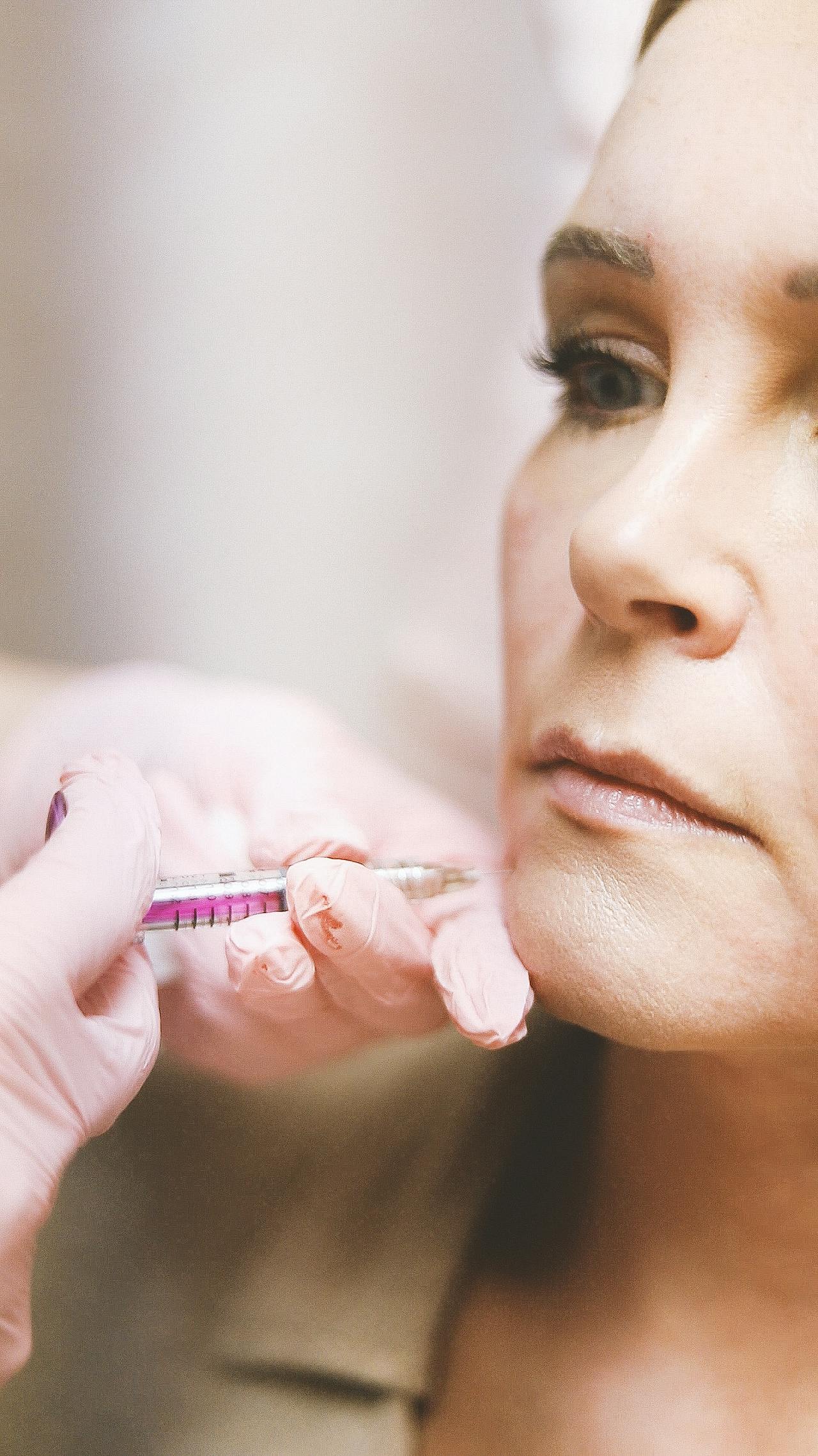 5 Things to Know Before RHA Dynamic Volume Cheek Filler