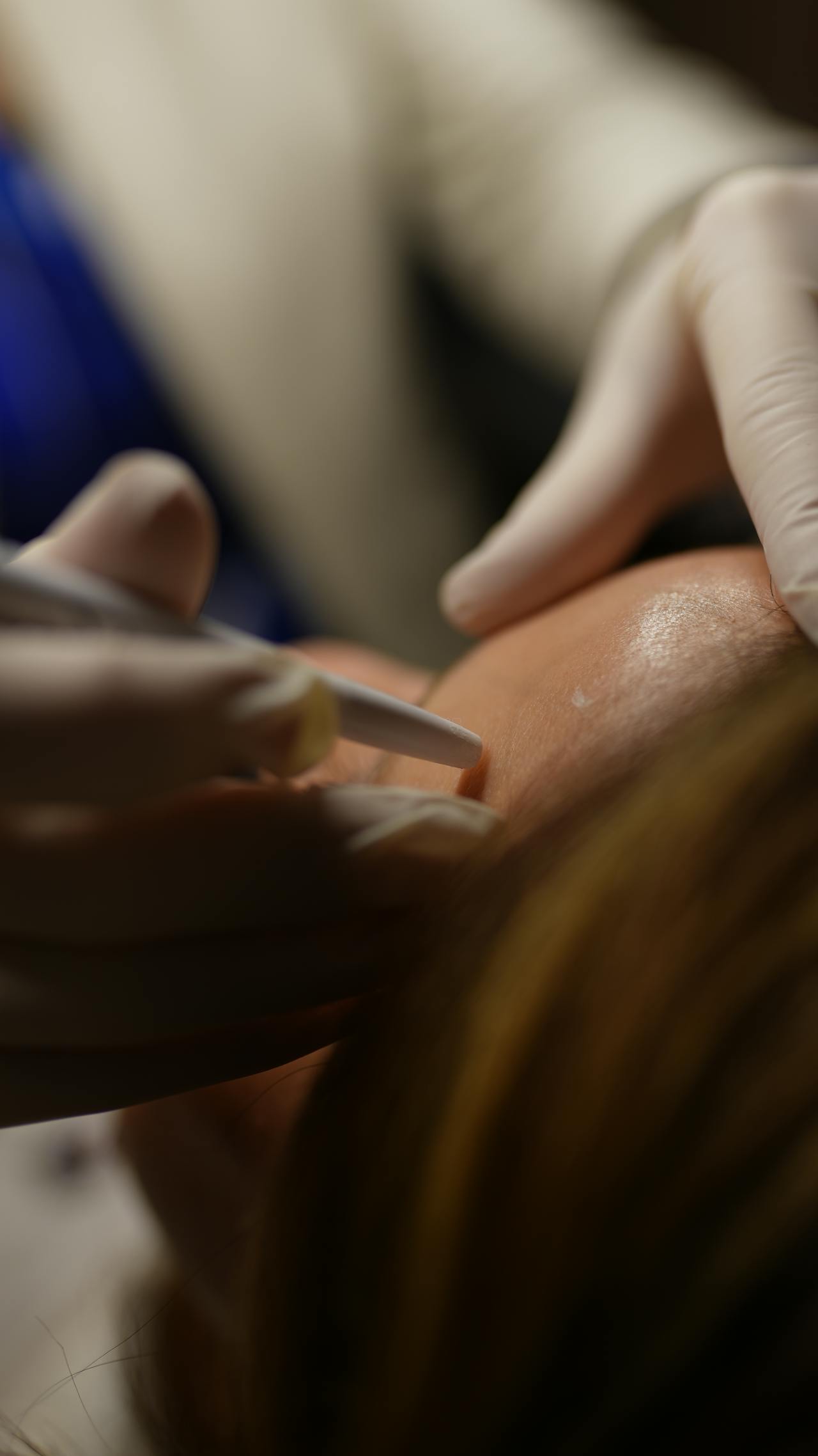 How Much Does 10 Medical Aesthetics Spots You Cost in New